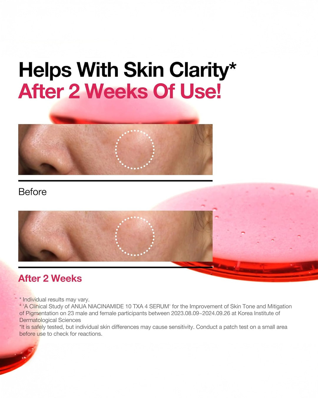 Niacinamide 10 TXA 4 Serum for Brightening and Dark Spots